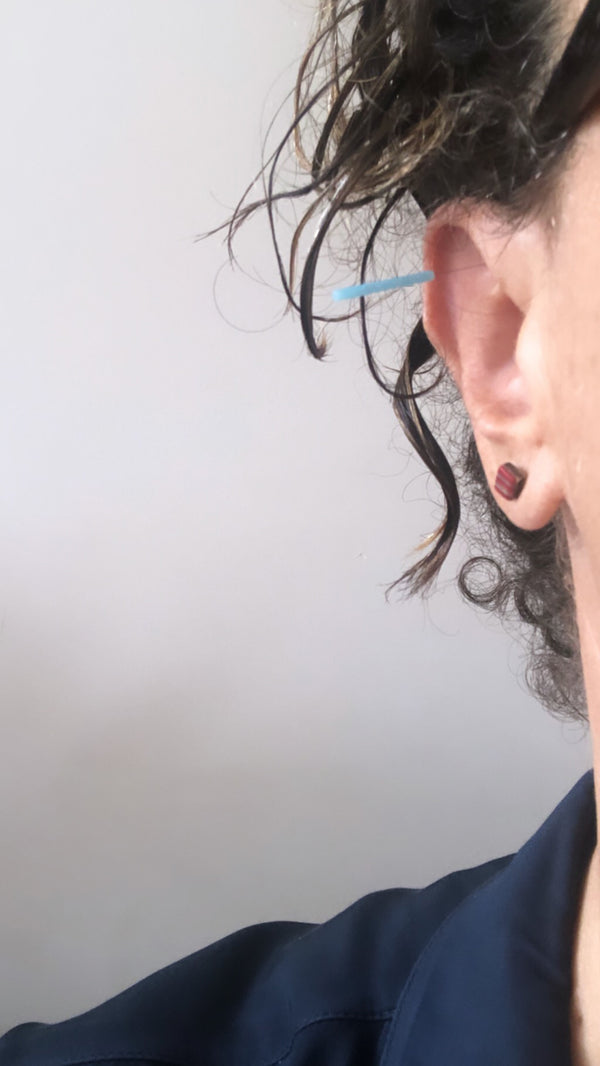 Why We Love Ear Acupuncture